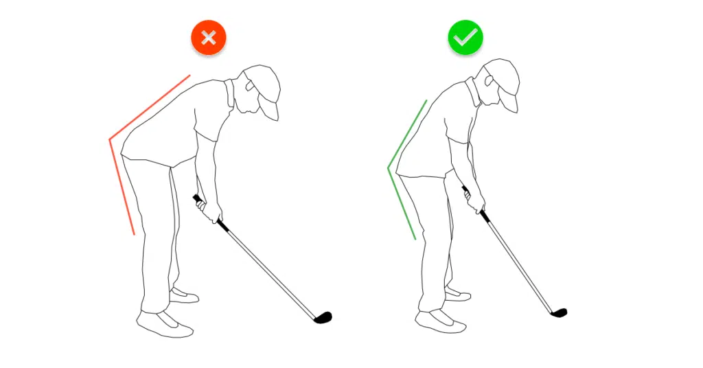 Excessive Forward Bend In Golf